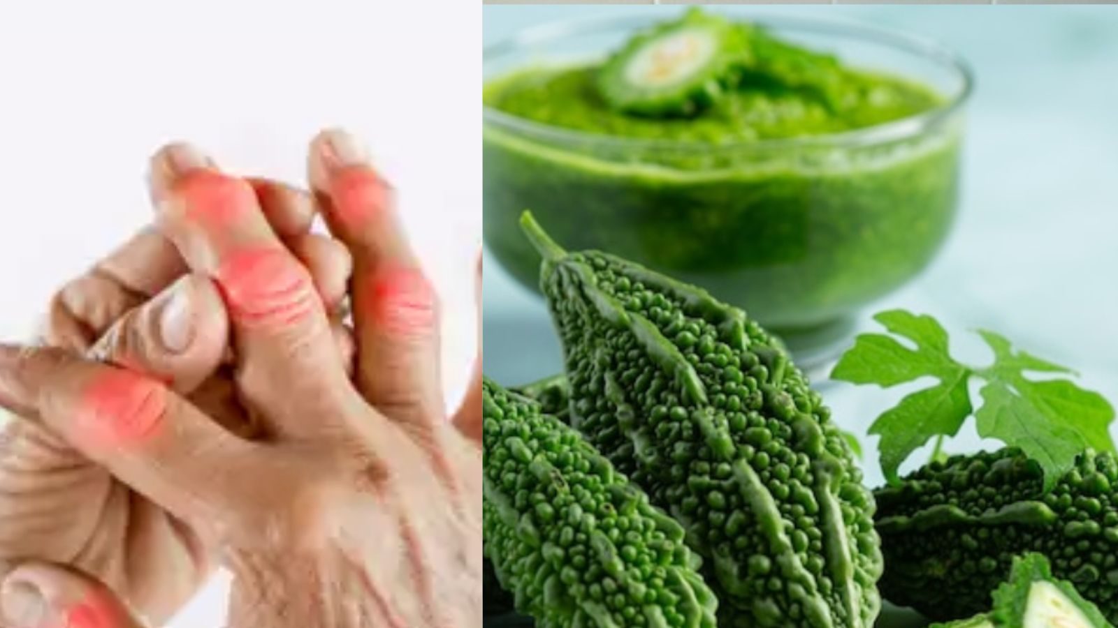 அதிக யூரிக் அமிலத்தால் ஏற்படும் மூட்டு வலியை குறைக்க உதவும் பாகற்காய்