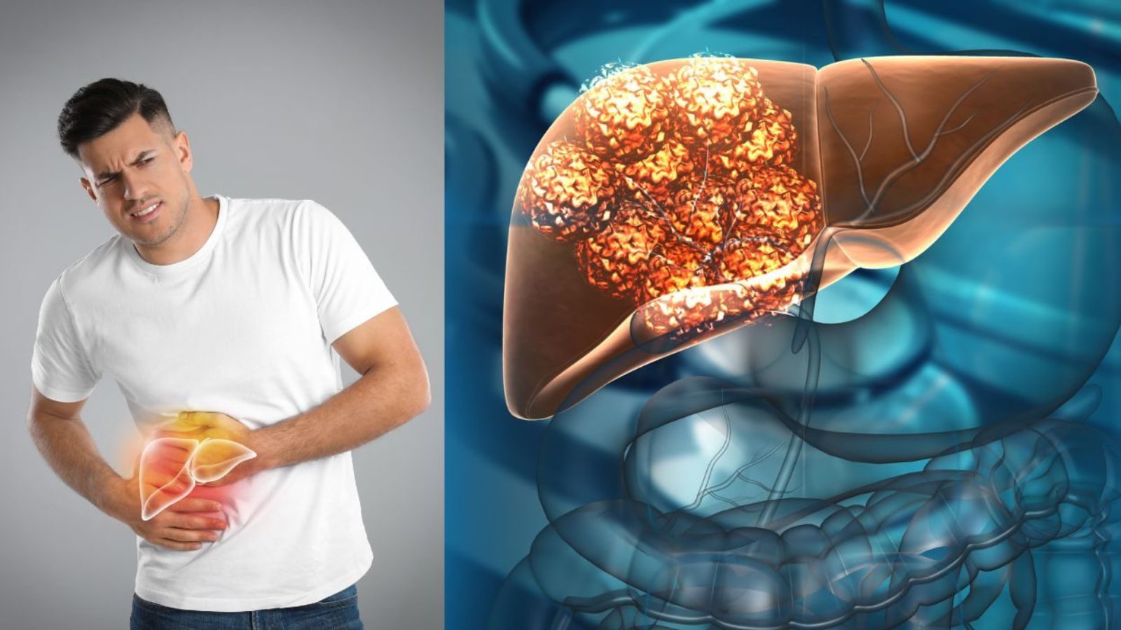 அஜீரணக் கோளாறுனு அப்டியே விட்டுடாதீங்க... கல்லீரல் புற்றுநோயின் அறிகுறிகள் என்ன..? தெளிவான விளக்கம்..!