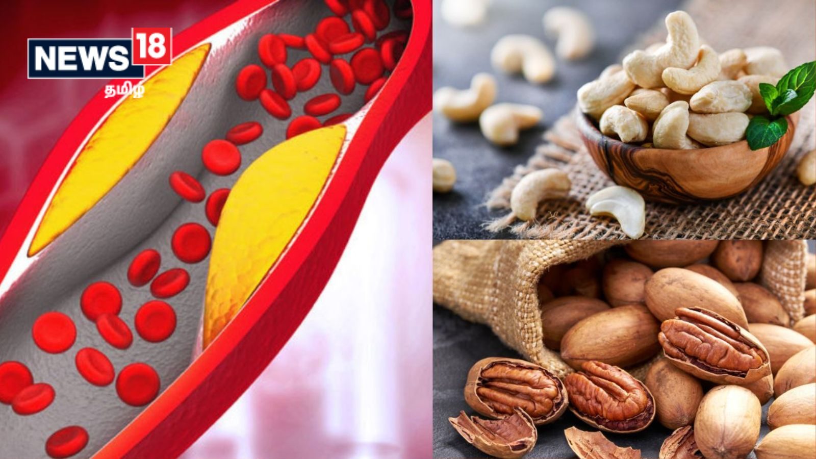 உடலில் உள்ள கெட்ட கொலஸ்ட்ராலை குறைக்க உதவும் 10 நட்ஸ் வகைகள்..!
