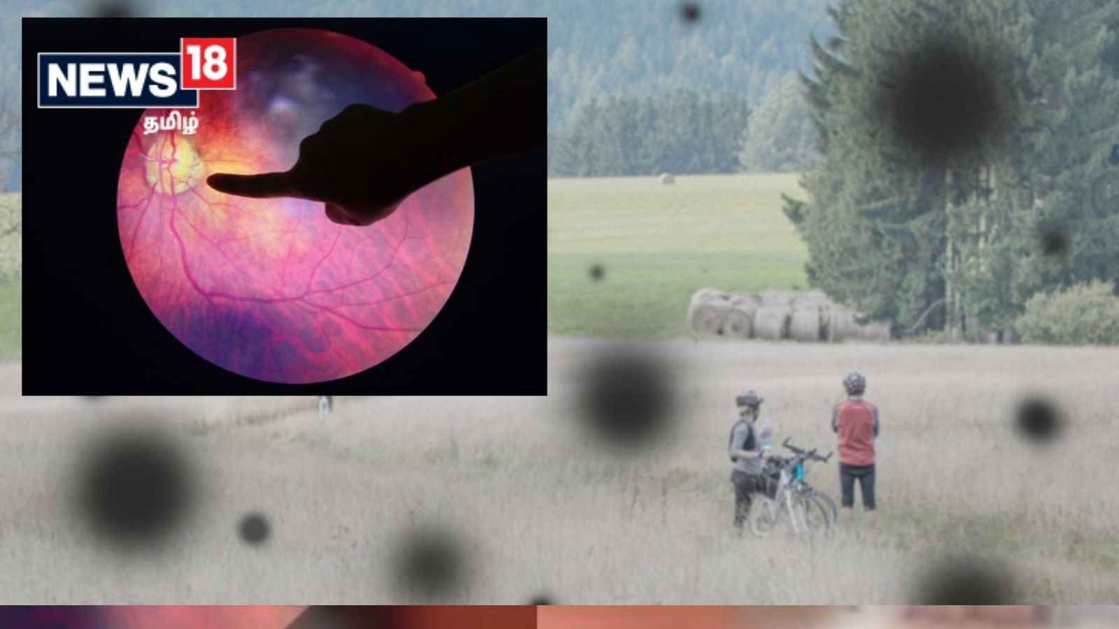 நீரிழிவு ரெட்டினோபதி குறித்து நீங்கள் தெரிந்துகொள்ள வேண்டியவை