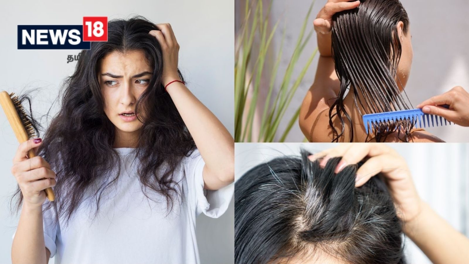 முடி உதிர்வு மற்றும் நரைமுடி பிரச்னையா.? இந்த வீட்டு வைத்தியங்கள் உங்களுக்கு உதவலாம்.!