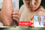 இரத்தப் புற்றுநோய் ஆரம்பநிலை அறிகுறிகள் எப்படி இருக்கும்..?