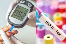 Hba1c ரிசல்ட் நார்மலாக இருந்து சுகர் அதிகமாக இருந்தால் நீரிழிவு நோயா?