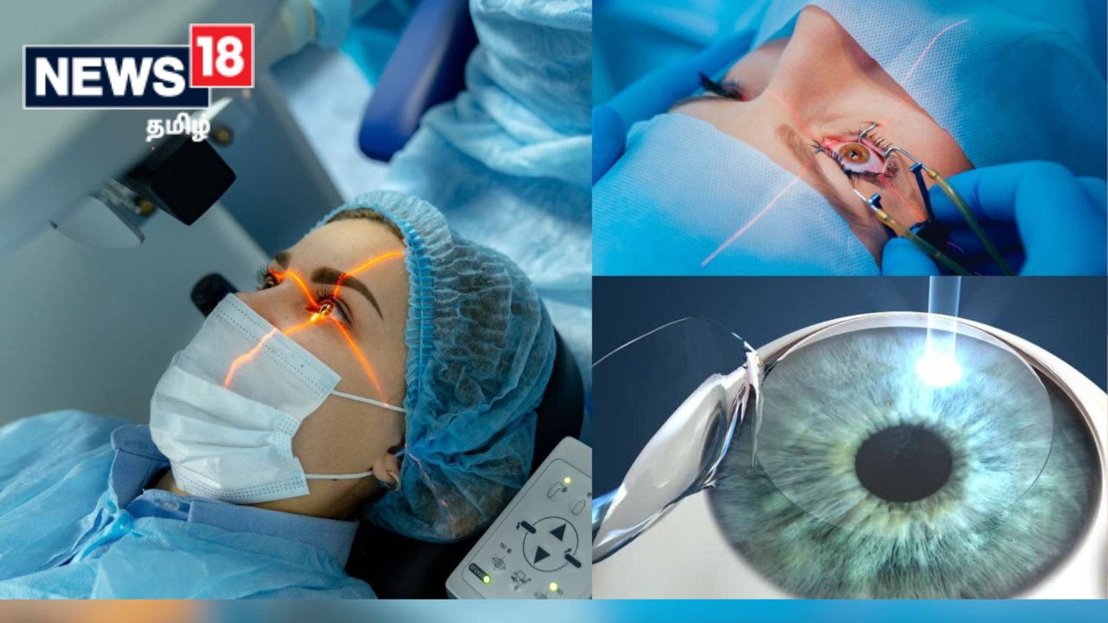 கண் பார்வைக்கு LASIK பண்ணலாமா வேண்டாமானு குழப்பமா இருக்கா..? இந்த பதிவு உங்களுக்கு தான்..!