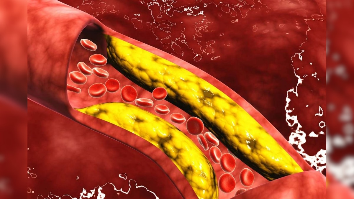 அதிகரிக்கும் நீரழிவு  நோயை எவ்வாறு தடுப்பது? (How to prevent progressive diabetes?) type1 and type2 Diabetes - https://bookday.in/
