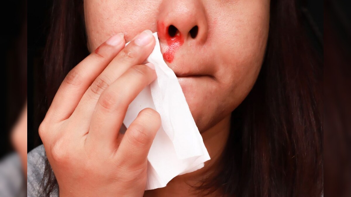 Bleeding Disorder : இரத்தப்போக்கு கோளாறு பற்றி தெரியுமா..? அறிகுறிகளும்.. சிகிச்சை முறைகளும்..! – News18 தமிழ்