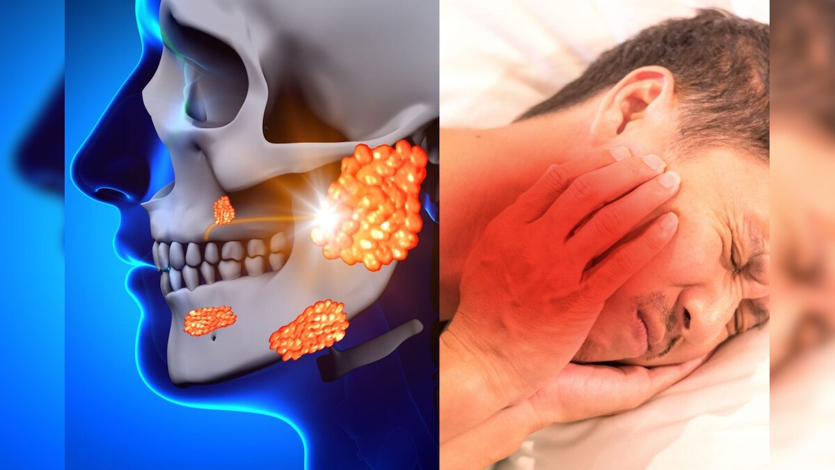 கேரளாவில் அதிகரிக்கும் அம்மைக்கட்டு நோய்.. இதன் அறிகுறிகள் என்ன..? – News18 தமிழ்