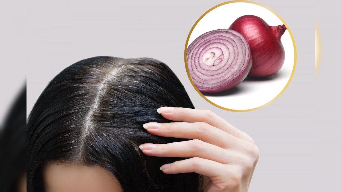 இந்த 2 பொருள் போதும்... உங்க நரை முடியை கருகருனு மாத்திடலாம்..! – News18 தமிழ்