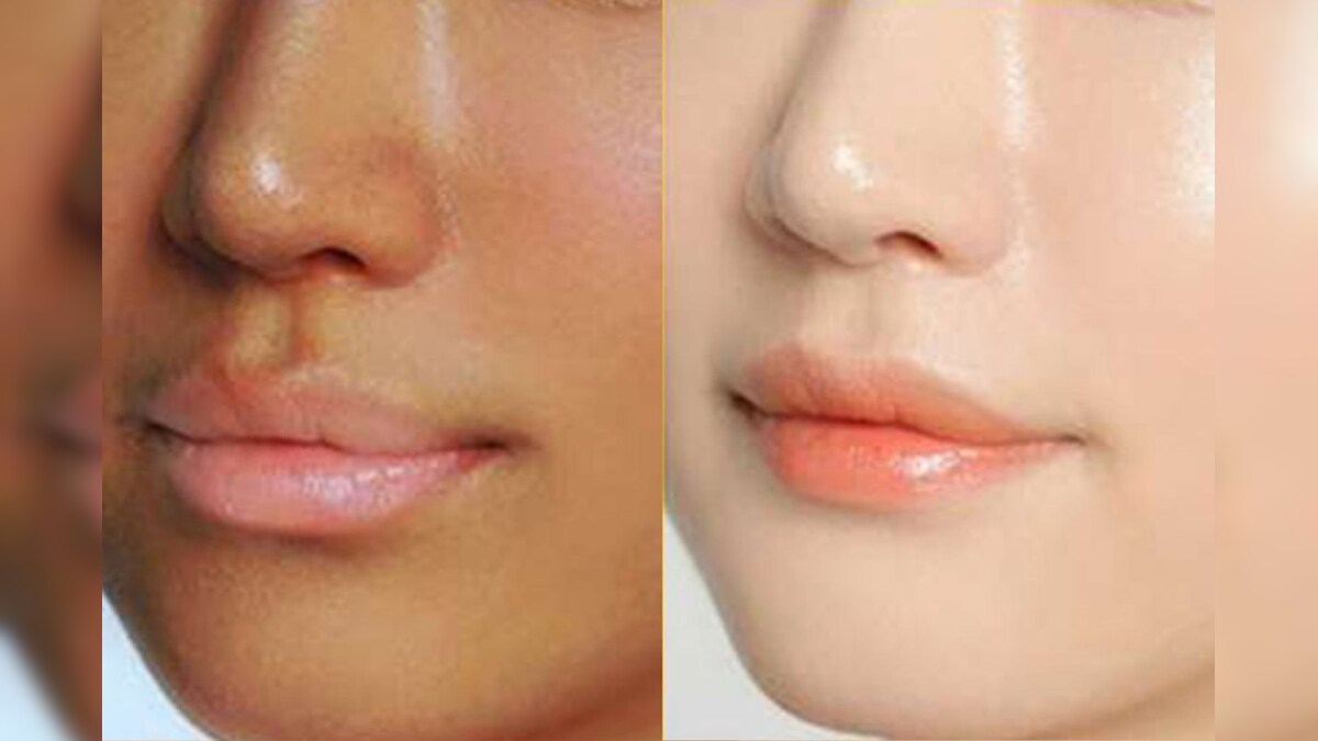 வெயிலால் உண்டான கருமை..  2 நாட்களில் பொலிவாக மாற்ற இரவு தூங்கும் முன் இதை செய்யுங்க.. – News18 தமிழ்