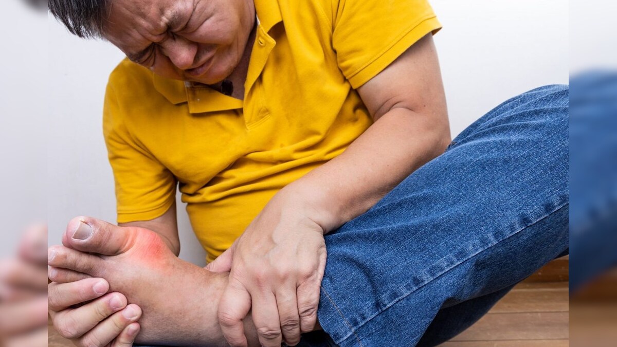 யூரிக் அமிலம் ஒரே வாரத்தில் இயற்கையாகவே குறையும்.. இந்த 4 விஷயங்களை செய்தால் போதும்..! – News18 தமிழ்