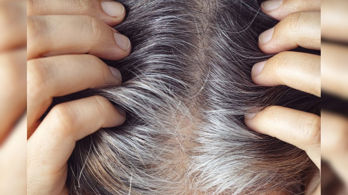 Grey Hair : நரைத்த முடிகளை இயற்கையான வழியில் கருமையாக்கலாம்! இணையத்தில் வைரலாகும் வீடியோ