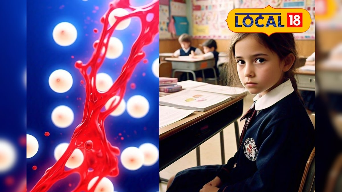 குழந்தைகளைப் பாதிக்கும் இரத்தச் சோகை... இரும்புச் சத்தை அதிகரிக்க இதை செய்தால் போதும்...