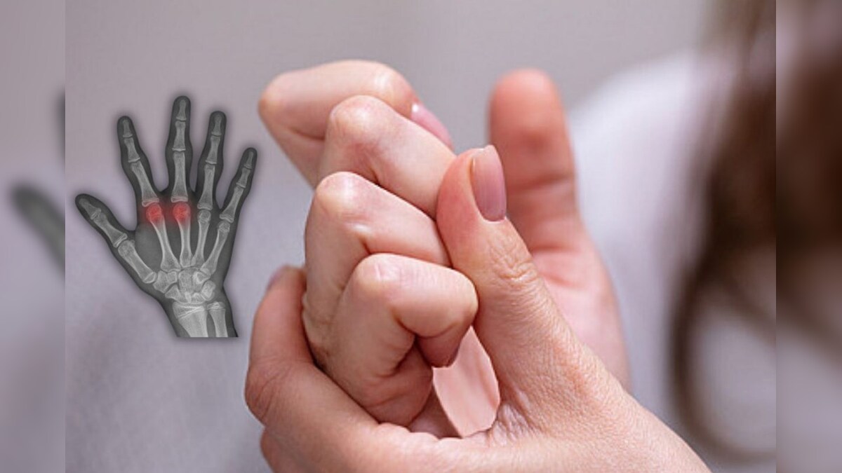 உங்களுக்கு விரல்களில் சொடுக்கு போடும் பழக்கம் இருக்கா..? இப்பவே நிறுத்திடுங்க - எச்சரிக்கும் மருத்துவர்கள்