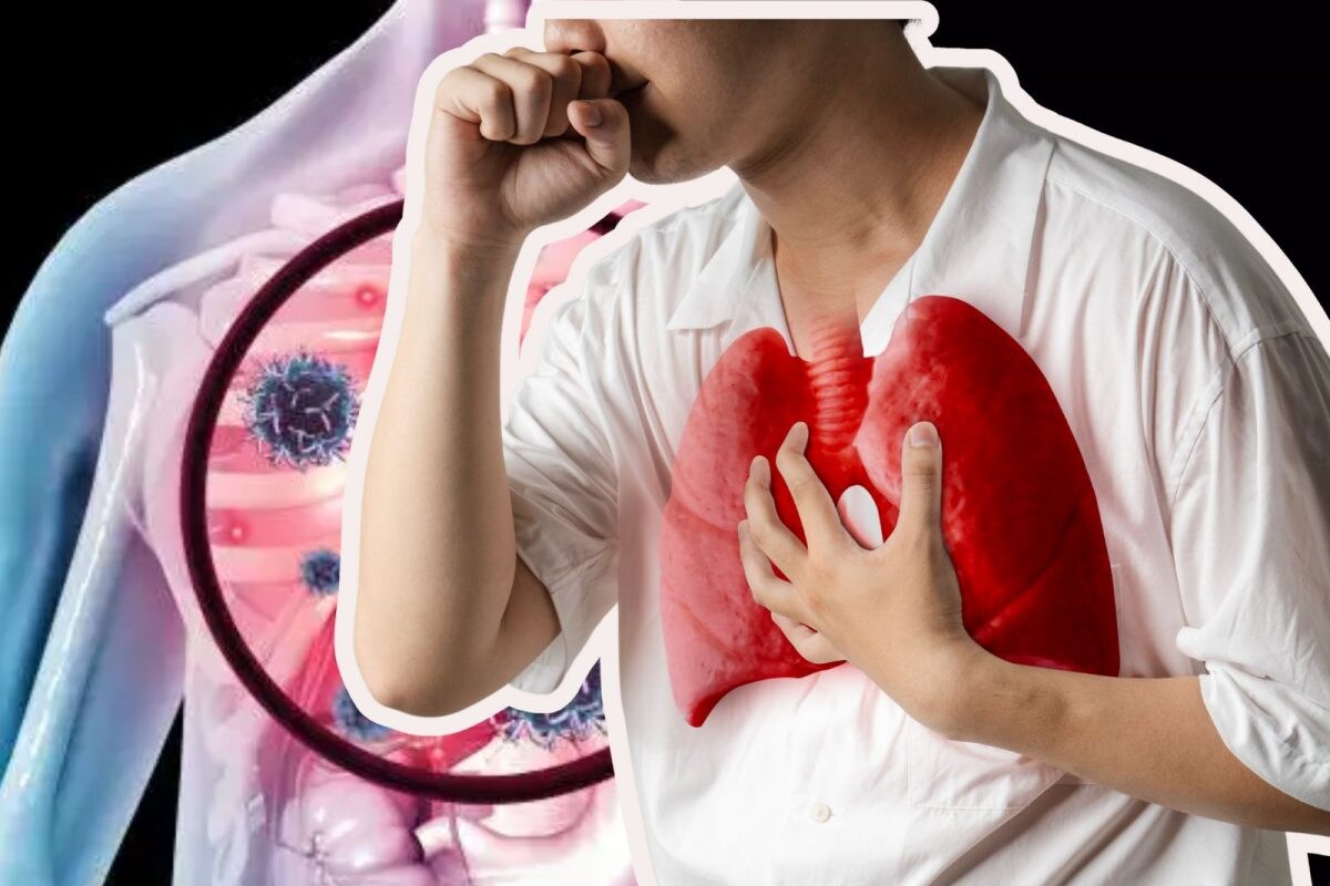 TB : இளைஞர்களிடையே காசநோய் பாதிப்பு அதிகரிப்பதற்கு காரணம் என்ன..? மருத்துவ விளக்கம்..! - News18 தமிழ்