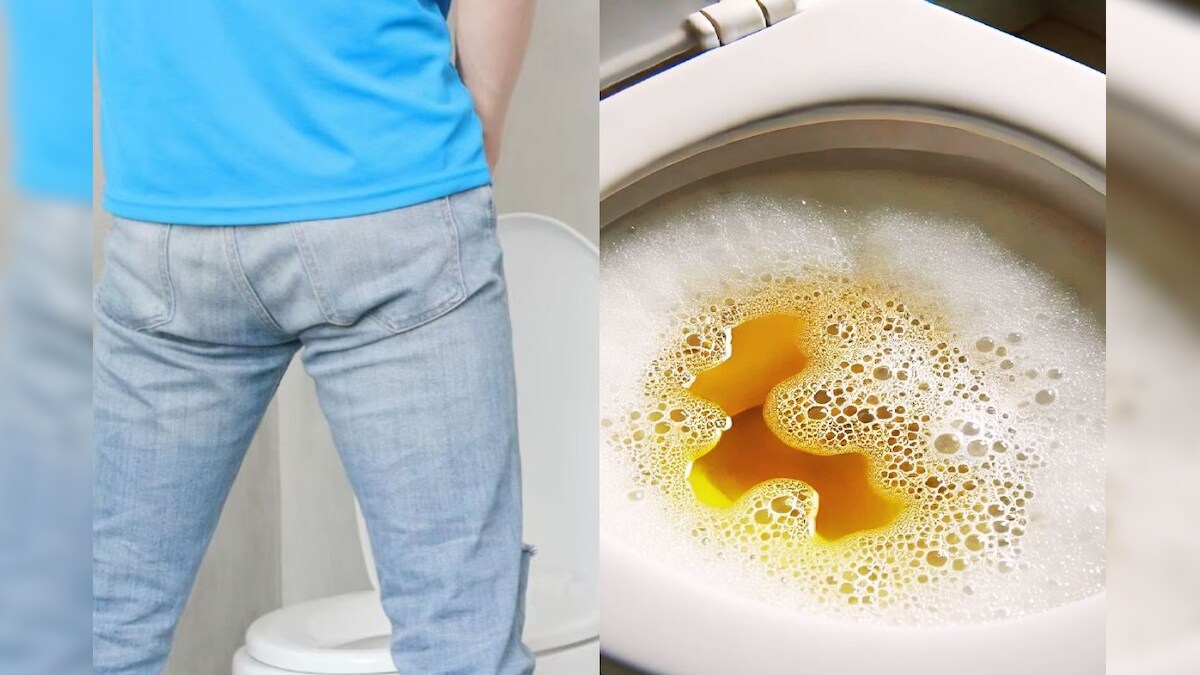 ஆண்களே உஷார்! சிறுநீர் கழிக்க மறக்காதீங்க.. இந்த ஆபத்தான நோய் வருமாம்!