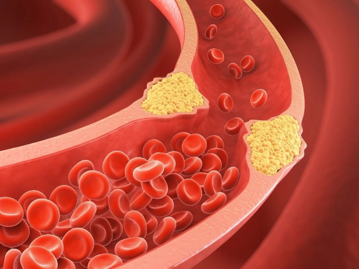 இந்த 7 விஷயங்களை நீங்க மாத்திக்கிட்டாலே போதும்.. கொழுப்பை அசால்டா குறைக்கலாம்..!