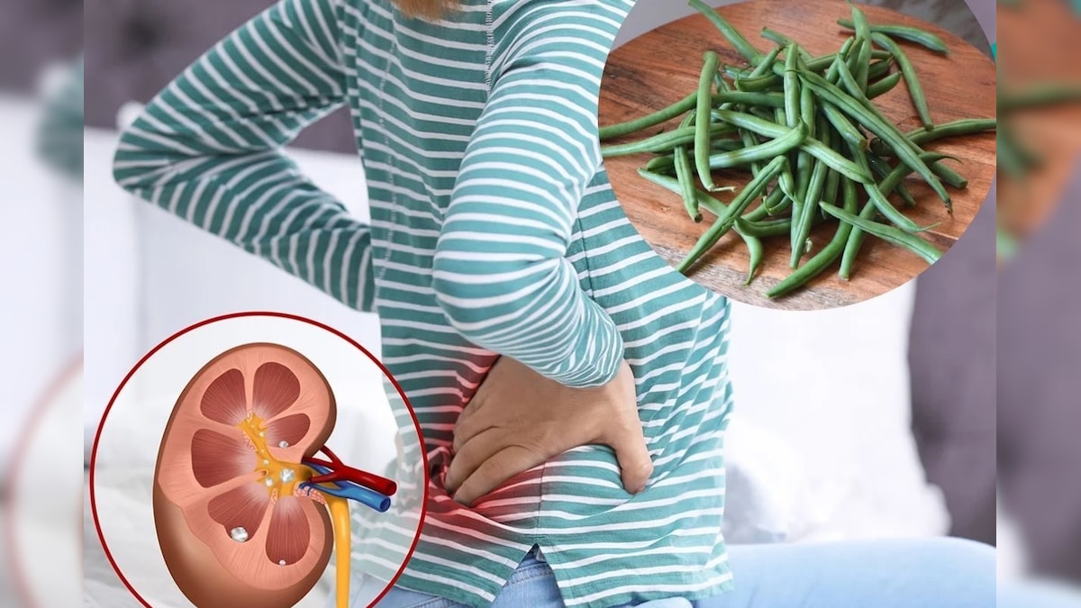 சிறுநீரக கல் கரைய பீன்ஸ் சாறு குடிப்பது பலன் தருமா..? மருத்துவரின் எச்சரிக்கை விளக்கம்..!