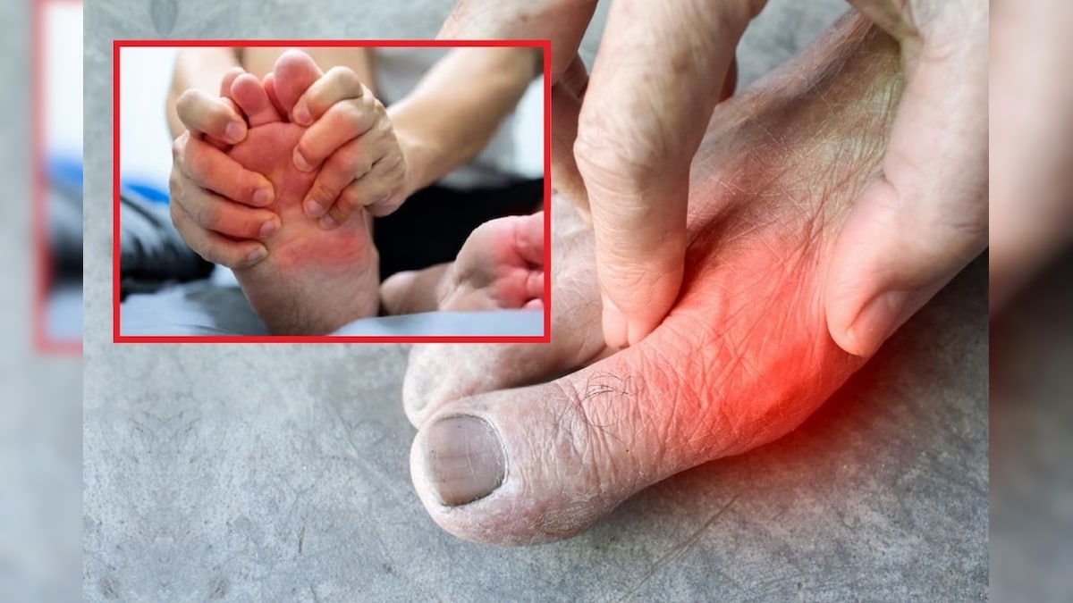 ஒரே மாதத்தில் எப்பேர்பட்ட  யூரிக் ஆசிட் அளவையும் சர்ருனு குறைக்க 7 டிப்ஸ்..!