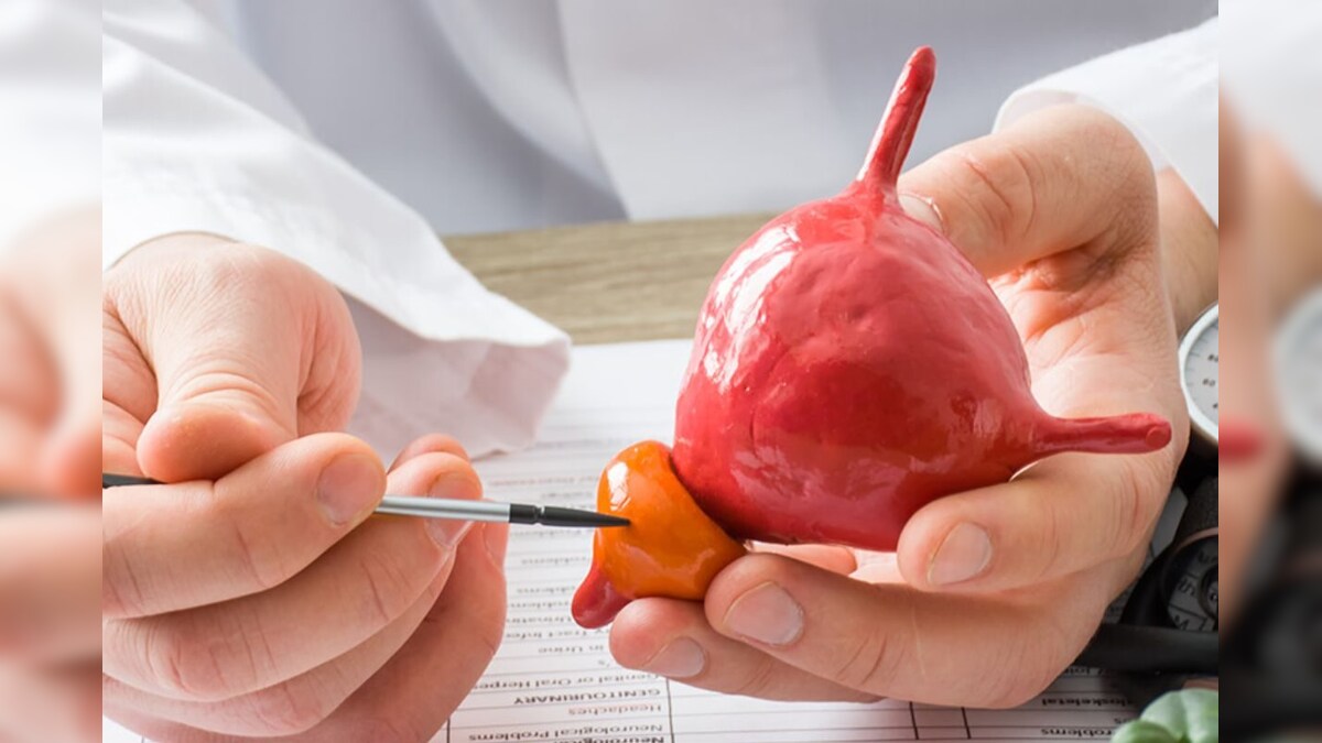 40 வயதுக்கு மேற்பட்ட ஆண்களை அமைதியாக கொல்லும் புரோஸ்டேட் புற்றுநோய்.. வராமல் தடுப்பதற்கான வழிமுறைகள்! - News18 தமிழ்