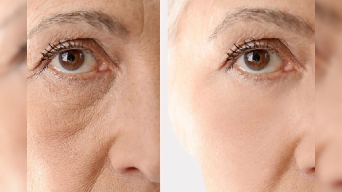 இளமையாக தோற்றமளிக்க வேண்டுமா? தினமும் 10 நிமிடங்கள் போதும்! - News18 தமிழ்