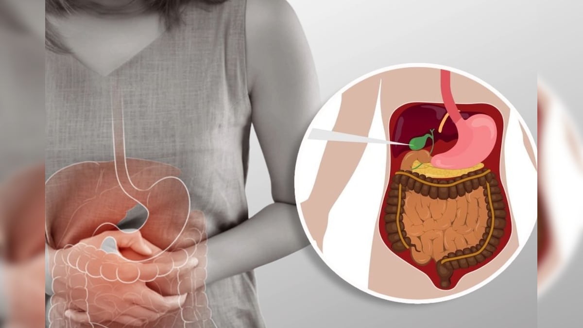 பித்தப்பை கற்களுடன் போராடுகிறீர்களா? வலியைக் குறைத்து ஆரோக்கியத்தை மேம்படுத்த   உதவும் 5 உணவுகள்!