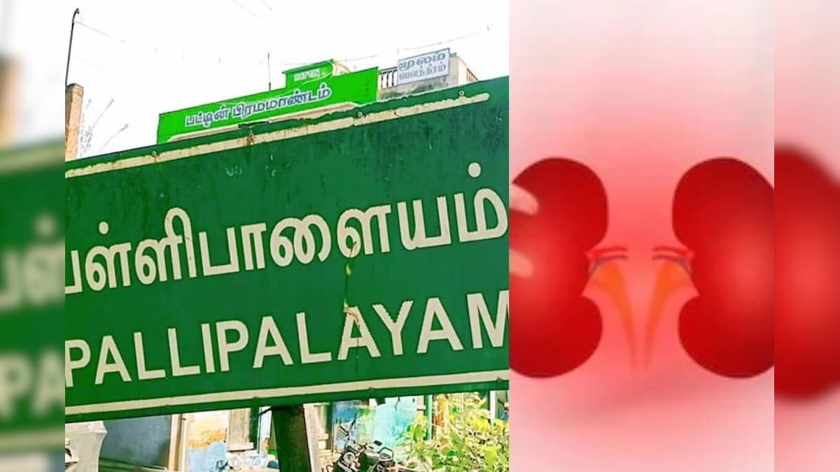 தமிழ்நாட்டை உலுக்கும் நாமக்கல் 'கிட்னி திருட்டு'... விசாரணையில் வெளிவந்த பகீர் தகவல்கள்! - News18 தமிழ்