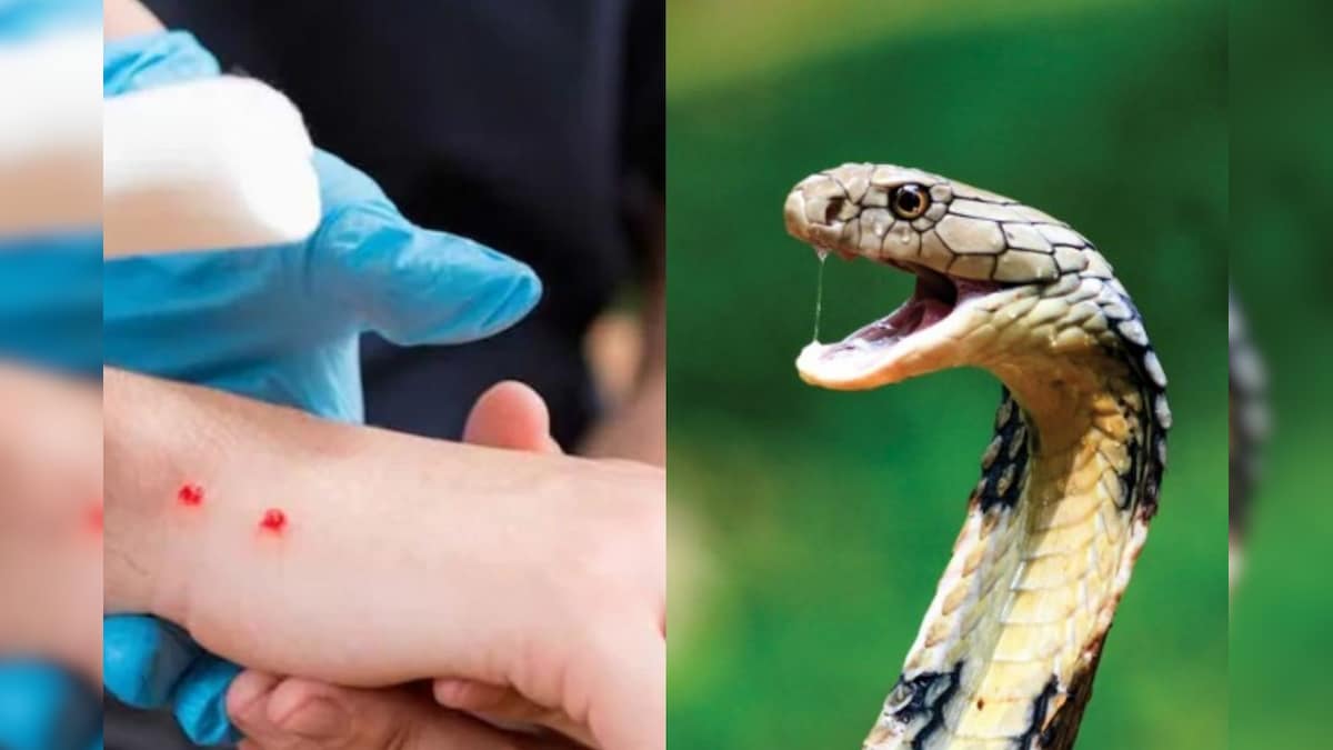 Snake Bite: பாம்பு கடித்த இடத்தில் இறுக்கமாக கட்டு போடலாமா..? அவசியம் தெரிஞ்சுக்கோங்க..!