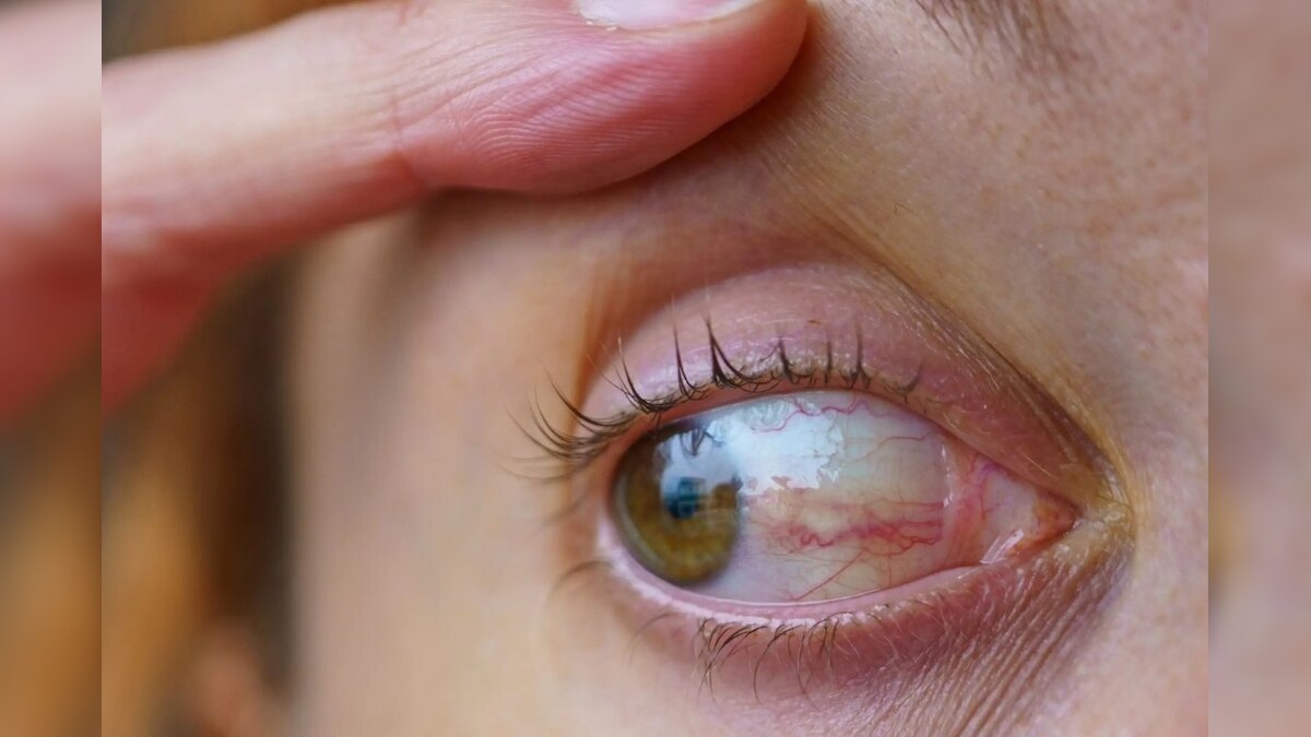 உங்க கண்களே இந்த 5 நோய்களை காட்டிக்கொடுத்துவிடும்... என்னென்ன அறிகுறிகள் தெரியுமா..? - News18 தமிழ்