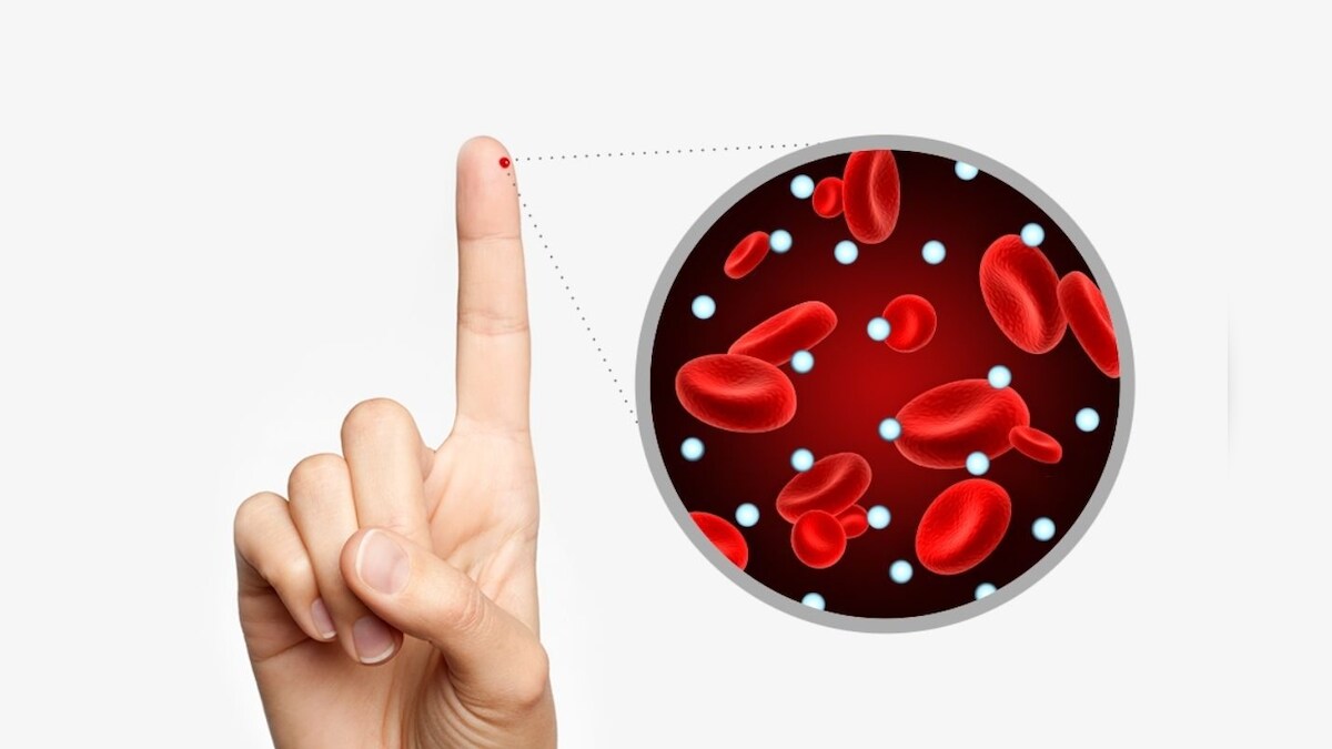 இன்சுலின் சுரப்பதில் பிரச்சனை.. உங்களுக்கே தெரியாமல் இந்த நோய்கள் வரலாம்... எச்சரிக்கும் அறிகுறிகள்..!