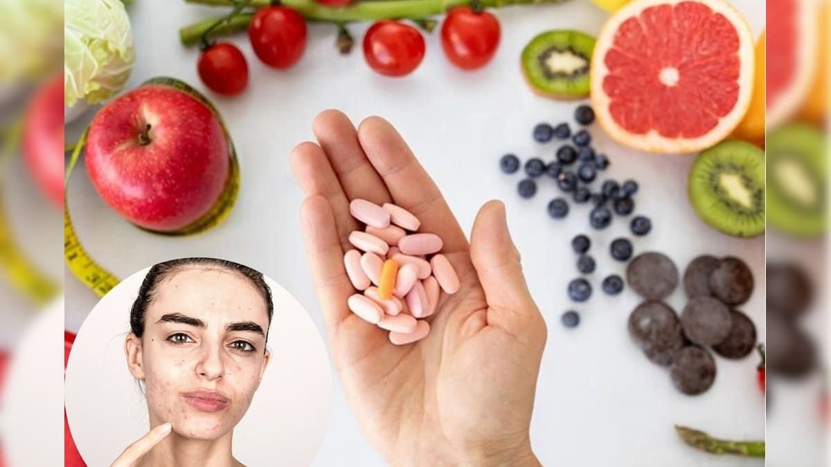இந்தியர்களிடையே அதிகரித்து வரும் வைட்டமின் குறைபாடு.. மருத்துவர்களின் 3 பரிந்துரை! | லைஃப்ஸ்டைல் - News18 தமிழ்