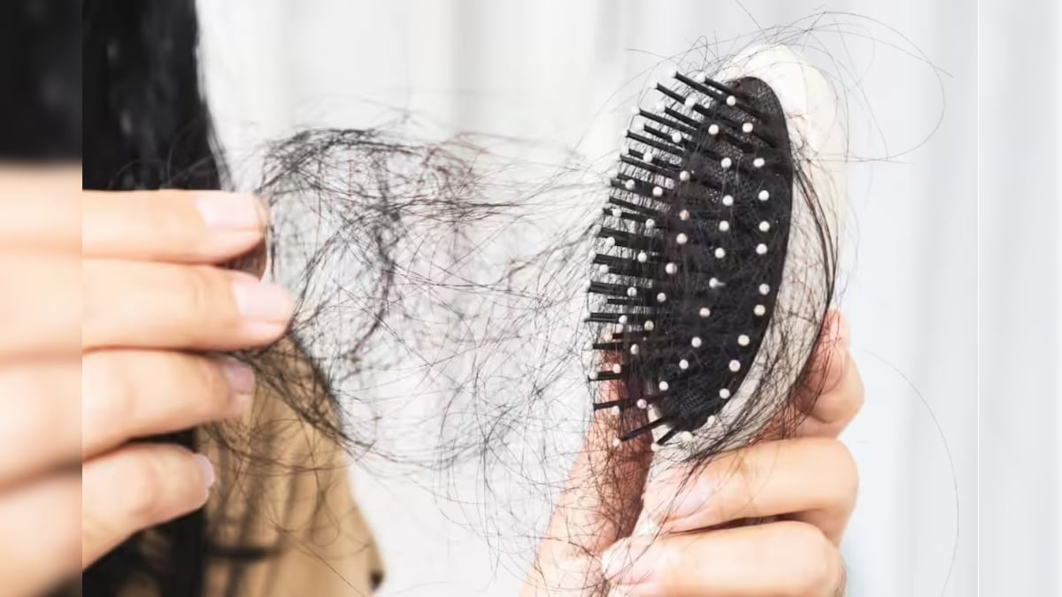 சர்க்கரை அதிகமா சாப்பிட்டா கூட முடி கொட்டுமா..? ஆய்வில் அதிர்ச்சி தகவல்..! | லைஃப்ஸ்டைல் - News18 தமிழ்