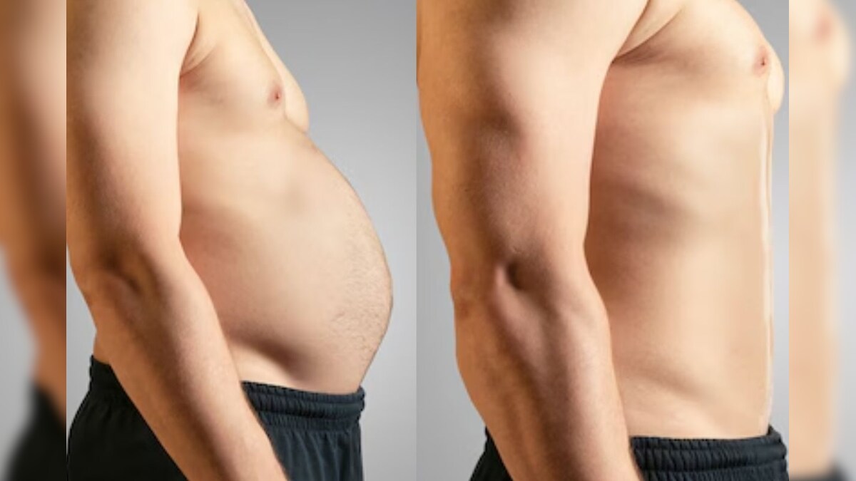 ஜிம் போகாமலே நீங்க வெயிட் லாஸ் பண்ணலாம்.. வீட்டில் இருந்துக்கிட்டே இதை மட்டும் பண்ணுங்க..! | லைஃப்ஸ்டைல் - News18 தமிழ்