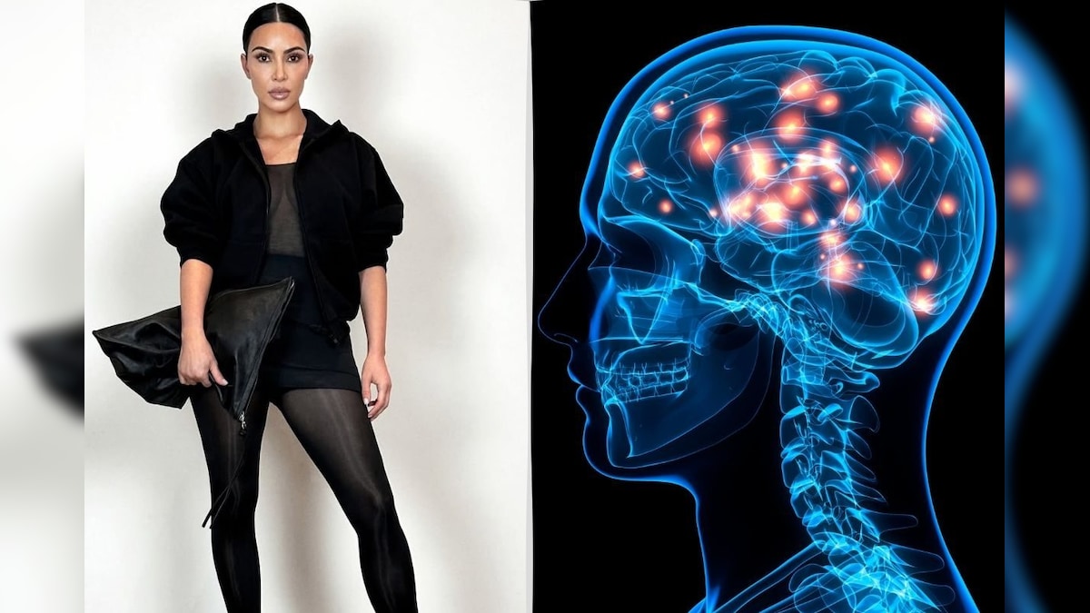 மோசமான நோயால் அவதிப்படும் பிரபல பில்லினியர் நடிகை... கிம் கர்தாஷியன் எதிர்கொண்டிருக்கும் Brain aneurysm என்பது என்ன? | லைஃப்ஸ்டைல் - News18 தமிழ்