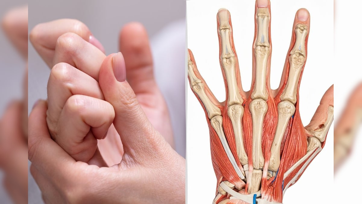 அடிக்கடி நெட்டி முறிப்பது ஆர்த்திரிட்டிஸ் பாதிப்பை ஏற்படுத்துமா? மருத்துவர் விளக்கம்! | லைஃப்ஸ்டைல் - News18 தமிழ்