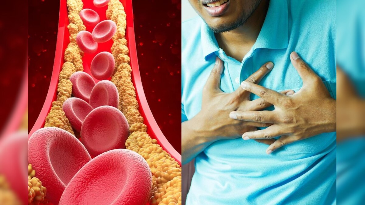 கொலஸ்ட்ரால் அதிகரிச்சா என்னென்ன பிரச்சனைகள் வரும் தெரியுமா..? உஷார்..! | லைஃப்ஸ்டைல் - News18 தமிழ்