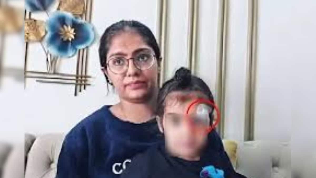 குழந்தையின் காயத்தில் தையல் போடுவதற்கு பதிலாக ஃபெவிக்விக் தடவிய மருத்துவர்...! இறுதியில் நடந்தது என்ன...? | இந்தியா - News18 தமிழ்