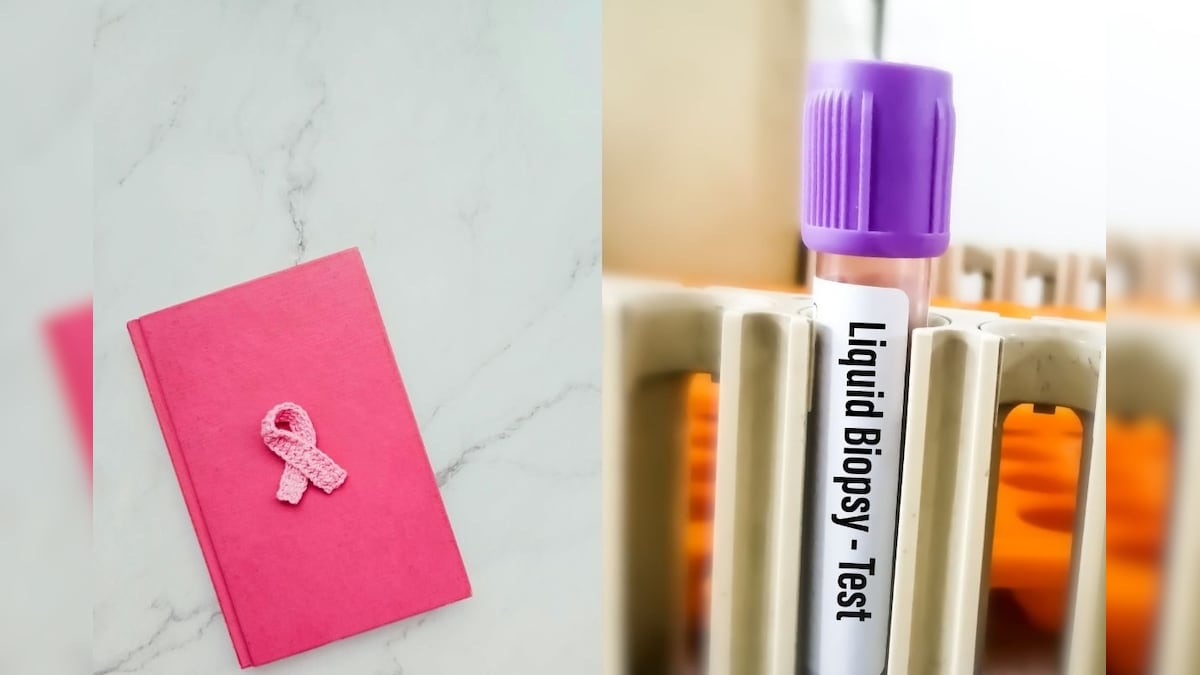 Cancer Precaution | புற்றுநோயை கண்டறிய ரத்தப் பரிசோதனையே போதும்? விஞ்ஞானிகள் சாதனை! | லைஃப்ஸ்டைல் - News18 தமிழ்