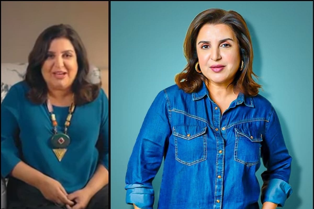 50 வயதுக்குப் பின் தசை குறைப்புக்கான சர்ஜரி, சரும பராமரிப்பு!