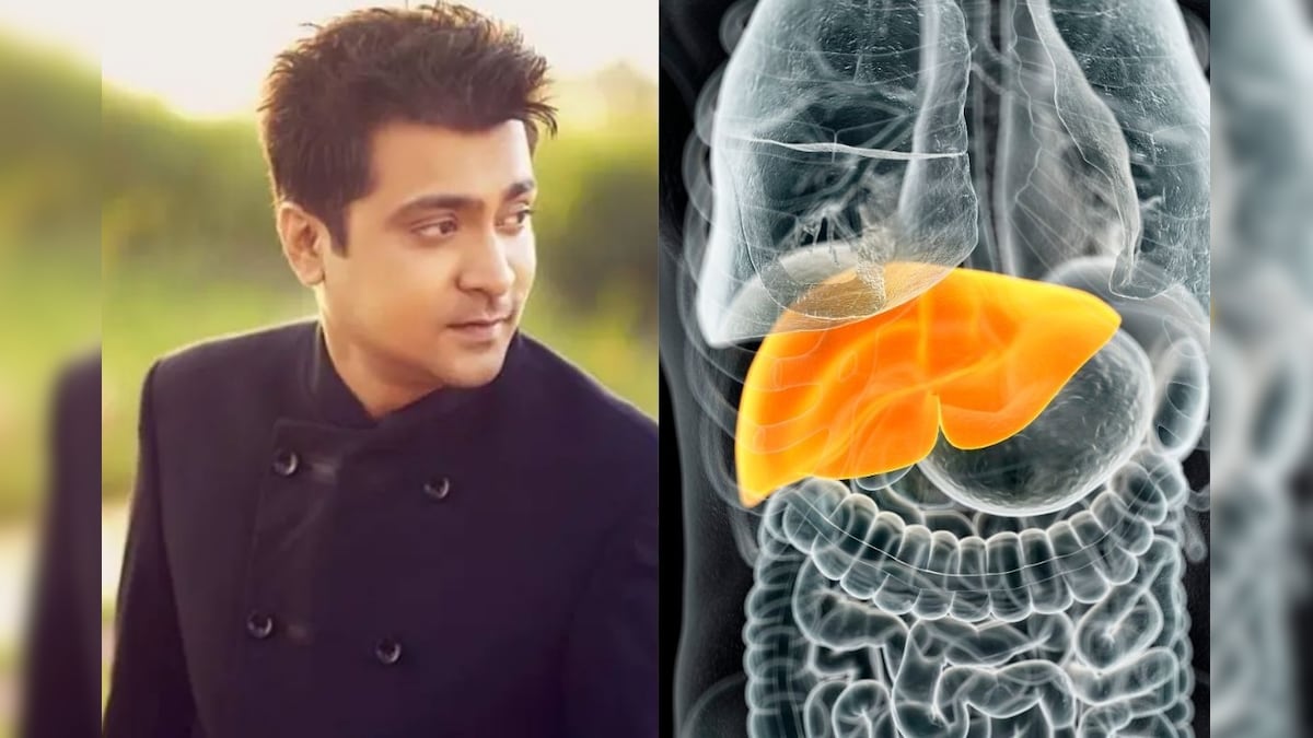 Liver Cirrhosis | நடிகர் அபினய் அவதிப்பட்டு வந்த கல்லீரல் சிரோசிஸ் எதனால் ஏற்படுகிறது? சிகிச்சை என்ன? | லைஃப்ஸ்டைல் - News18 தமிழ்