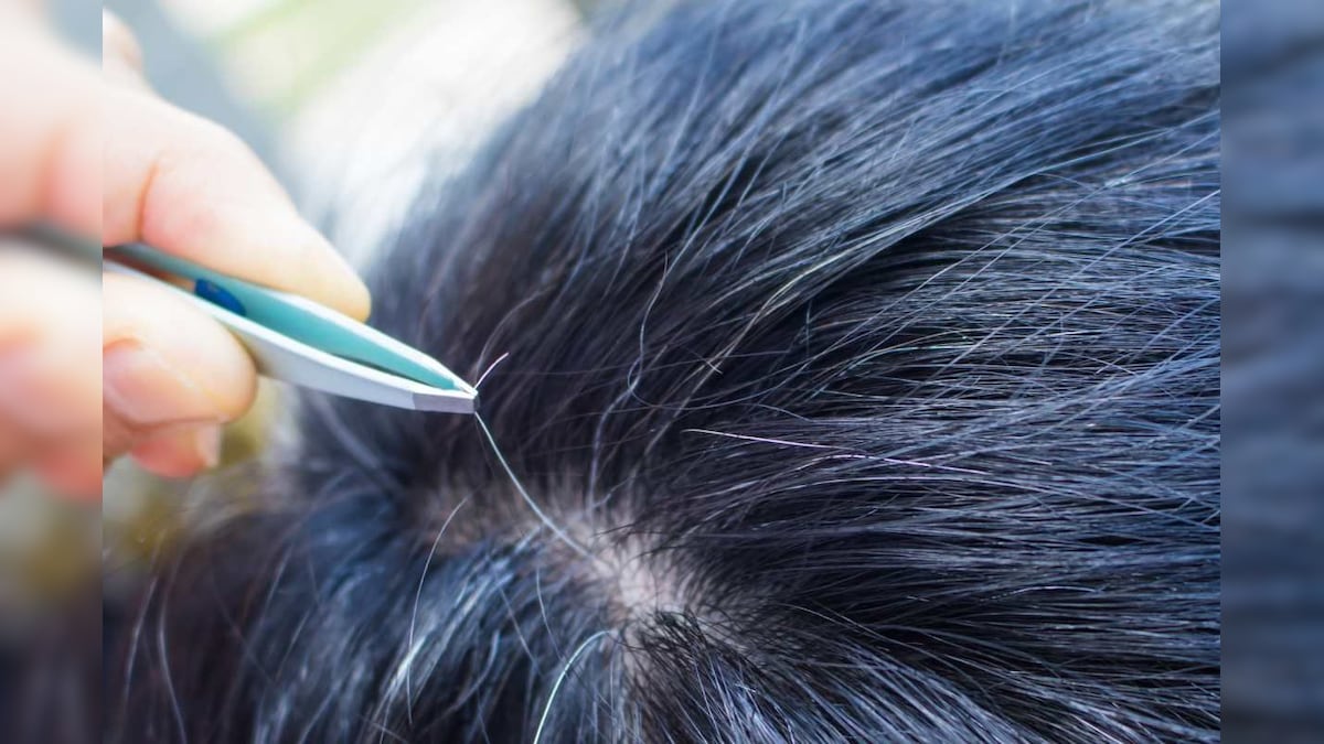 ஒரு நரை முடியைப் பிடுங்கினால் அதிக நரை முடிகள் வரும் என்பது உண்மையா..? விளக்கும் மருத்துவர்..! | லைஃப்ஸ்டைல் - News18 தமிழ்