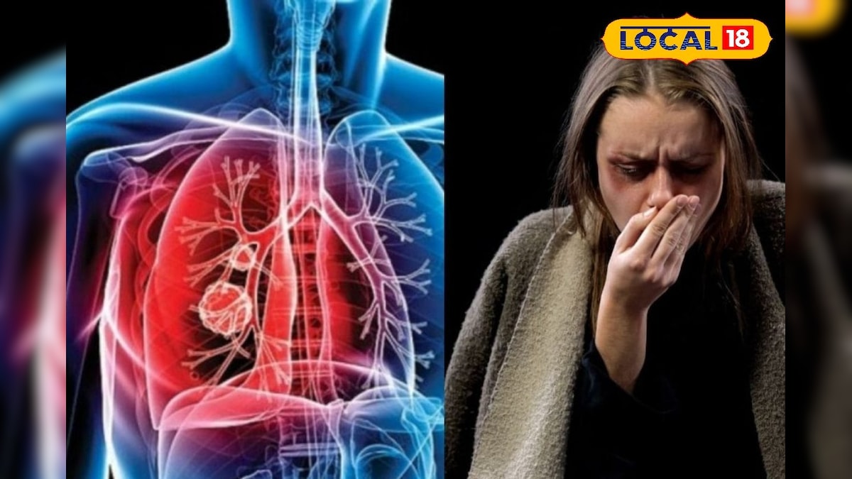 காசநோய் ஒழிப்பு திட்டம்!! தீவிர கண்காணிப்பில் நோயாளிகள் - அரசு எடுத்துள்ள மெகா ஆக்சன்... | உடல்நலம் - News18 தமிழ்