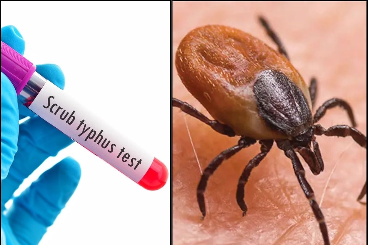 தமிழ்நாட்டை அச்சுறுத்தும் புதிய காய்ச்சல்... தப்புவது எப்படி?