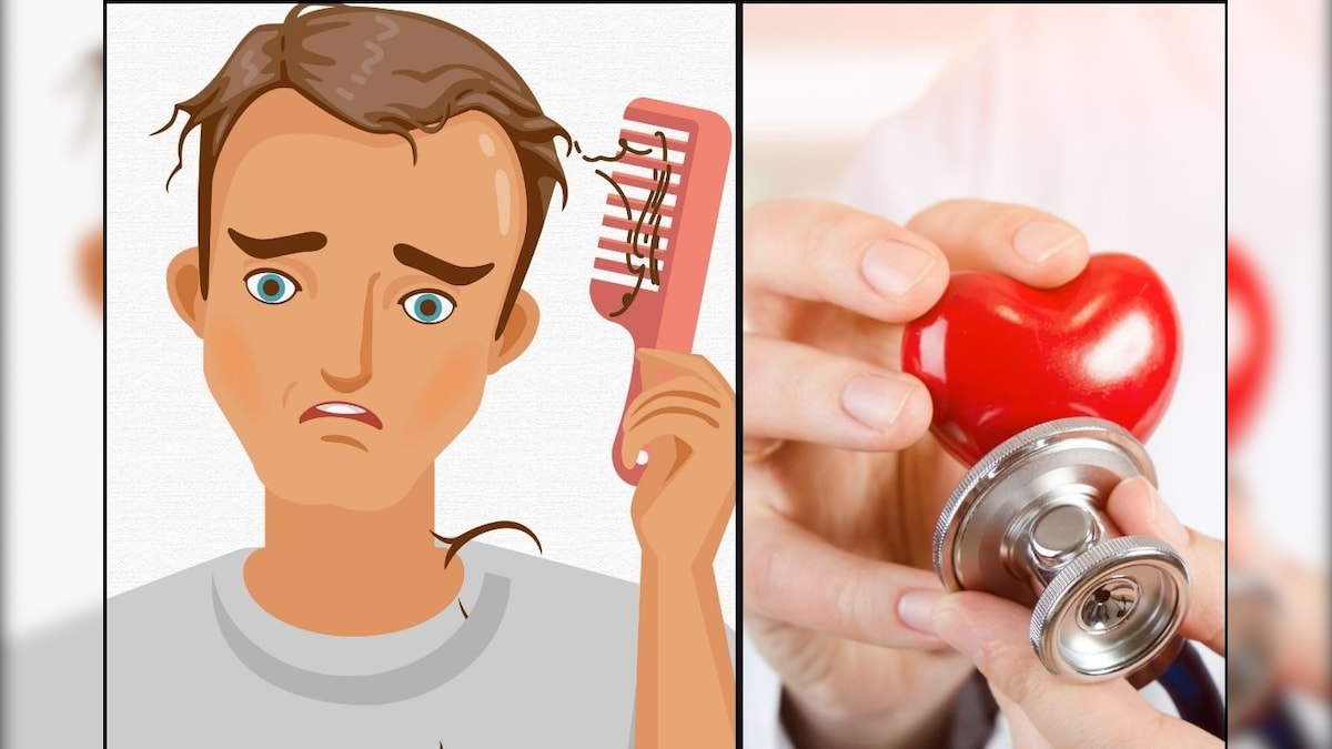 Baldness | இளவயதில் வழுக்கைத் தலை ஏற்படுவது இதயப் பிரச்னைக்கான அறிகுறியா? ஆண்களே உஷார்... ஆய்வில் பகீர் தகவல்! | லைஃப்ஸ்டைல் - News18 தமிழ்
