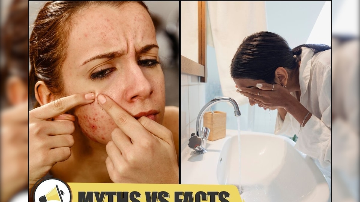Myths Vs Facts | அடிக்கடி முகம் கழுவினால் முகப்பருக்களை தடுக்கலாமா? உண்மை என்ன? | லைஃப்ஸ்டைல் - News18 தமிழ்