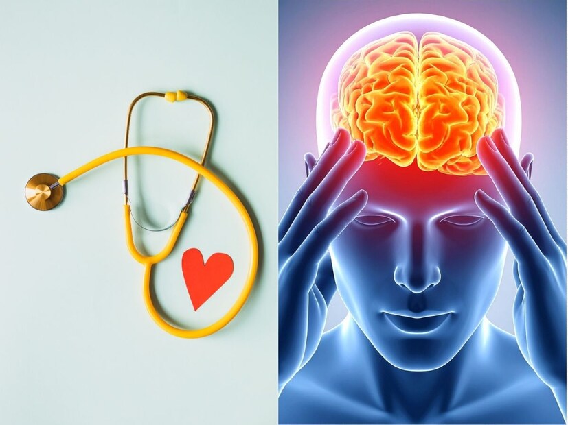  ஸ்டெண்ட் என்றவுடன், மாரடைப்பு சிகிச்சை போல இதிலும் ஒரு கருவி ரத்தநாளத்தில் பொருத்தப்படும் என நினைக்க வேண்டாம். ஏனெனில், பக்கவாதம் என்பது ரத்த நாளங்களில் ஏற்படும் அடைப்பை குறிக்கிறது. இப்படி ரத்தநாளத்தில் அடைப்பு ஏற்படும்போது, அந்த அடைப்பை சரிசெய்ய ‘Stent Clot Retriever’ (க்ளாட் ரிட்ரைவர்) கருவி பயன்படுத்தப்படும் (அடைப்பு நீக்கப்பட்ட பின், கருவி வெளியே எடுக்கப்பட்டுவிடும்). இதுவே, ரத்த நாளங்கள் ஏதேனும் காரணங்களால் சுருங்கியிருந்தால், அப்போது ஸ்டெண்ட் கருவி பொருத்தப்பட்டு அது விரிவாக்கப்படும். அடைப்பு வேறு, சுருங்குதல் வேறு என்ற வித்தியாசத்தை நாம் இங்கே புரிந்து கொள்ள வேண்டும். டெல்லி எய்ம்ஸில் தற்போது கண்டுபிடிக்கப்பட்டிருப்பது Clot Retriever-தான். இது அடைப்பை நீக்க உதவுகிறது.