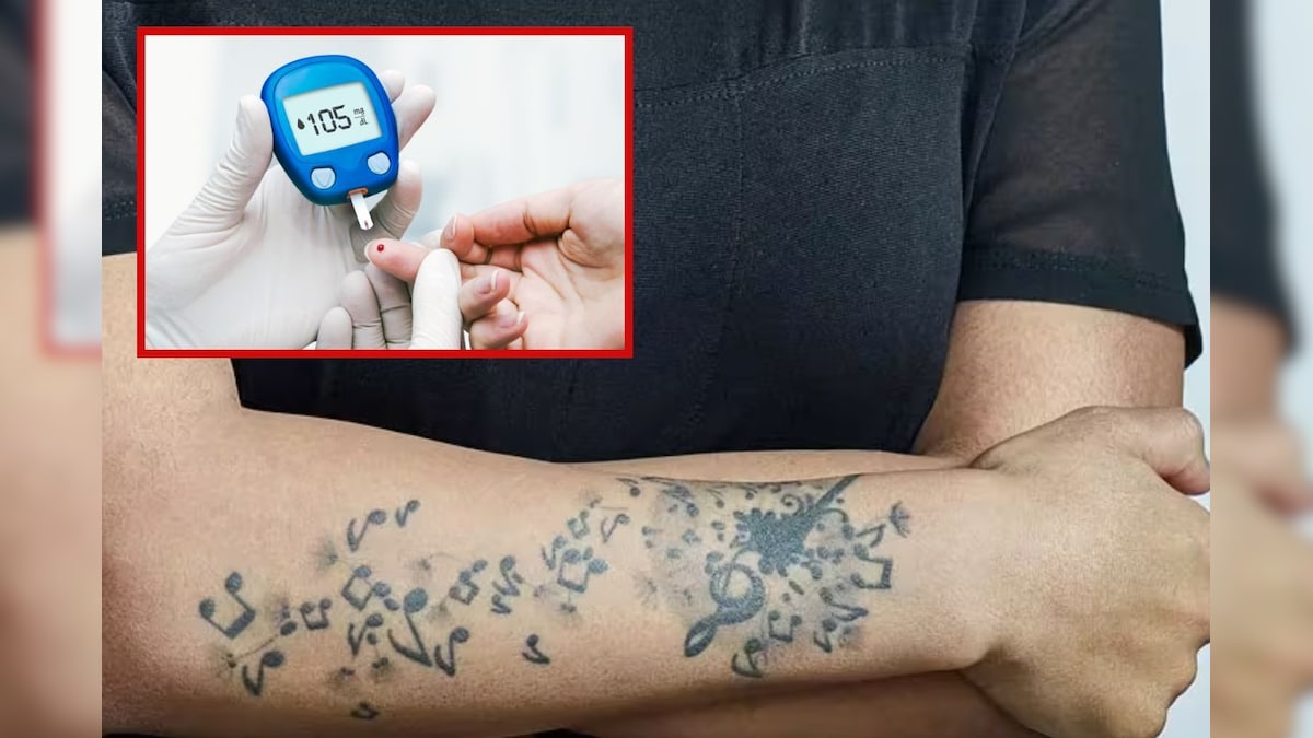 நீரிழிவு நோயாளிகள் டாட்டூ போடலாமா..? முழுமையான விளக்கம்..! | லைஃப்ஸ்டைல் - News18 தமிழ்