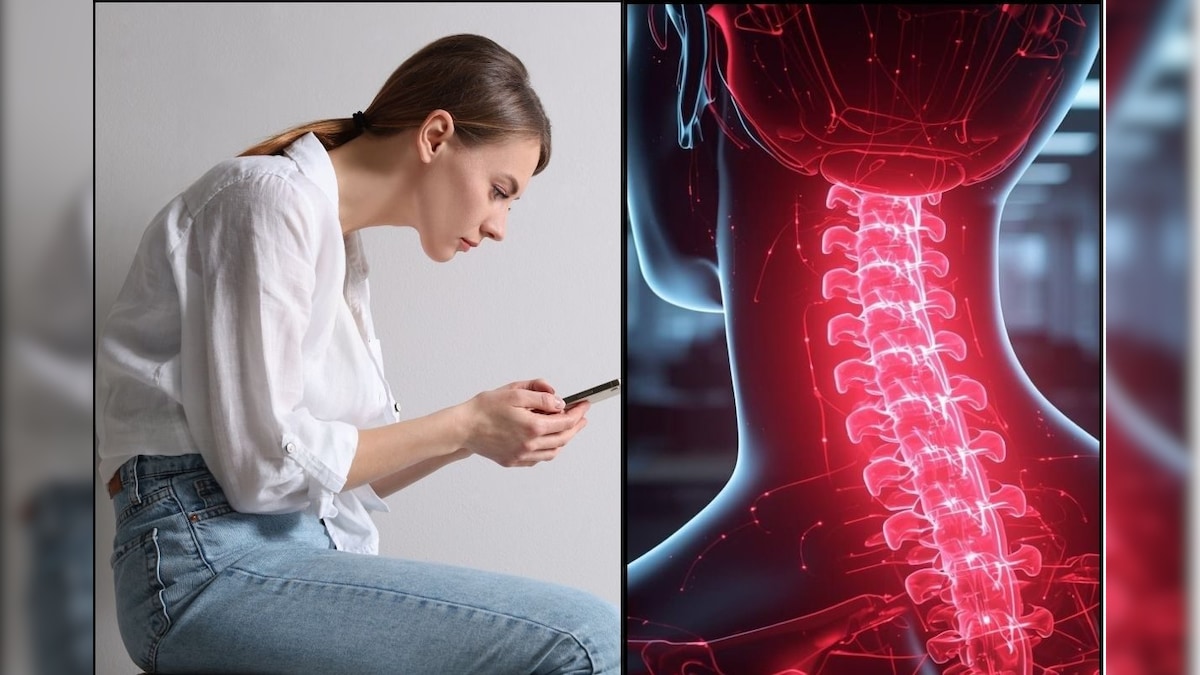 எப்போதும் குனிந்தபடி ஃபோன் பார்ப்பவரா நீங்கள்? இந்த அறிகுறிகள் தெரிஞ்சா அலர்ட்ட்ட்! #TechNeckSyndrome | லைஃப்ஸ்டைல் - News18 தமிழ்