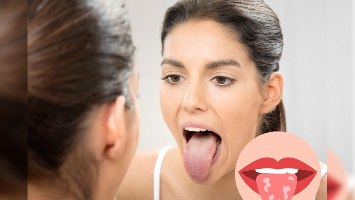 Tongue Colour | வெள்ளைப்பூச்சுக்கள் முதல் சாம்பல் நிறம் வரை... நாக்கின் நிறம் சொல்லும் செய்தி என்ன? | லைஃப்ஸ்டைல் - News18 தமிழ்