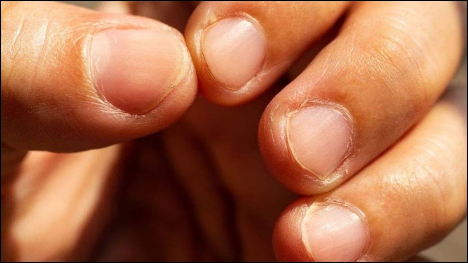 Nails and Lifespan | நீங்கள் எவ்வளவு காலம் வாழ்வீர்கள் என்பதை உங்கள் நகங்களே சொல்லும்! எப்படி என்று தெரிந்தால் நீங்கள் ஆச்சரியப்படுவீர்கள் | லைப்ஸ்டைல் போட்டோகேலரி - News18 தமிழ்