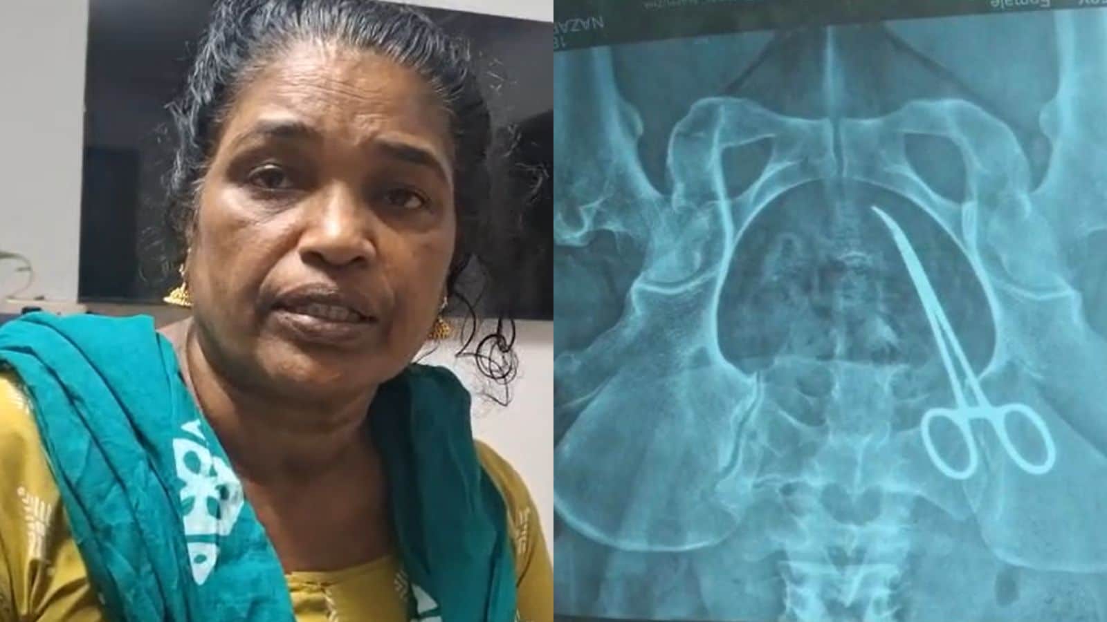 பெண்ணின் வயிற்றில் கத்தரிக்கோலை வைத்து அறுவை சிகிச்சை... 5 ஆண்டுகளாக வேதனையில் துடித்த பெண்... கேரளாவையே உலுக்கிய சோகம்... | India News (இந்தியா செய்திகள்) - News18 தமிழ்